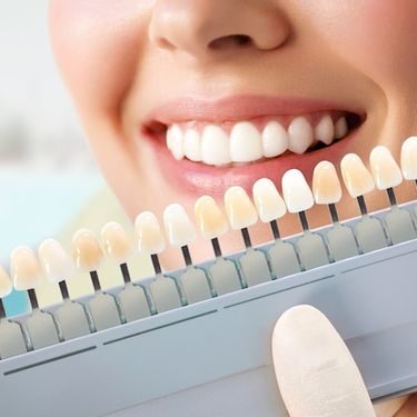 Teeth whitening